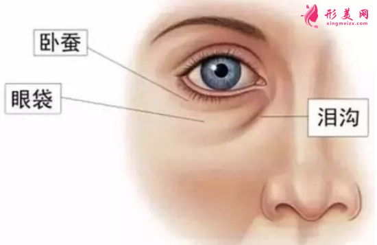 祛眼袋手術(shù)后可以喝酒嗎