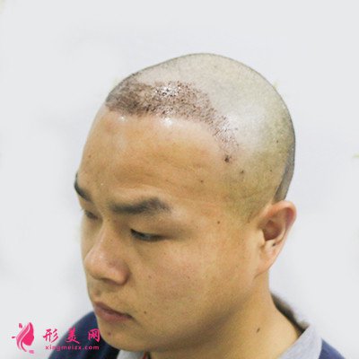 5f5d69117ef6-audio.jpg