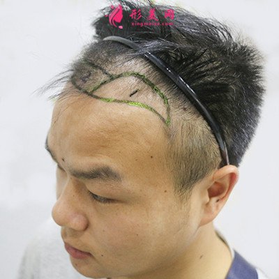 22d83da7e41b-audio.jpg