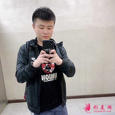 重慶毛發(fā)移植手術(shù)術(shù)后恢復(fù)情況分析 術(shù)后 重慶毛發(fā)移植手術(shù)術(shù)后恢復(fù)情況分析