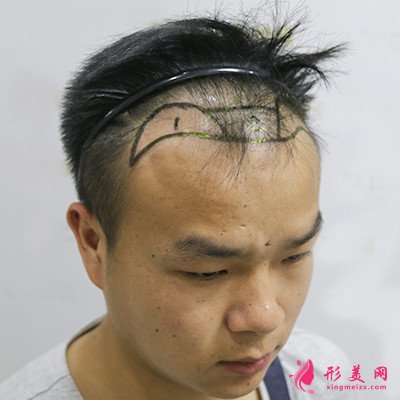 98d45f03d40d-audio.jpg
