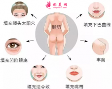 自體脂肪填充臉部吃什么可以加快消腫