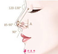 自體軟骨隆鼻哪里做得比較好？