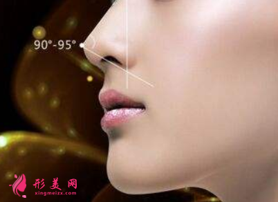 自體軟骨隆鼻后需要怎么護(hù)理