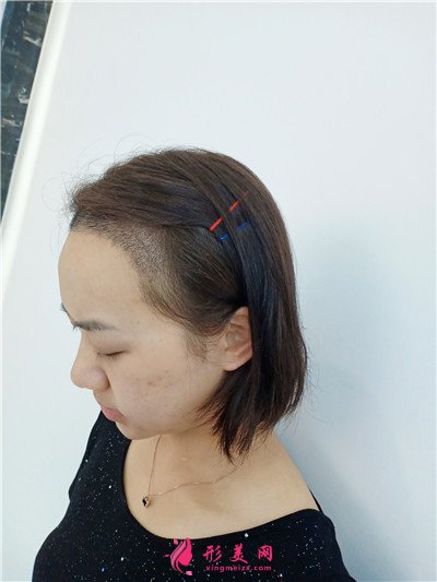 a4866a4aa618-audio.jpg