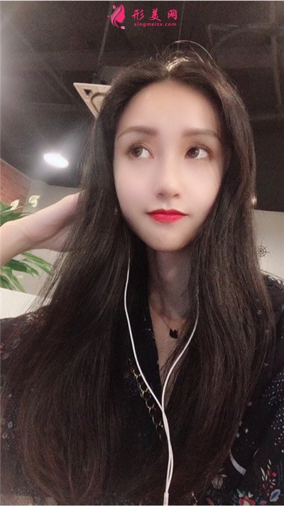 武漢發(fā)際線種植手術術后恢復效果分享 術后 武漢發(fā)際線種植手術術后恢復效果分享