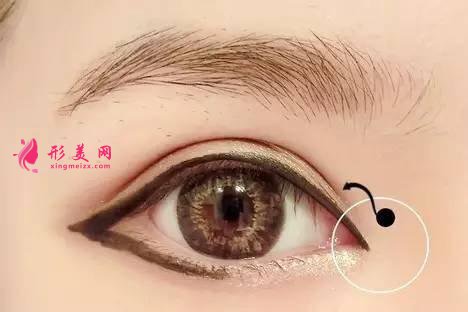 開眼角出現(xiàn)明顯疤痕的原因