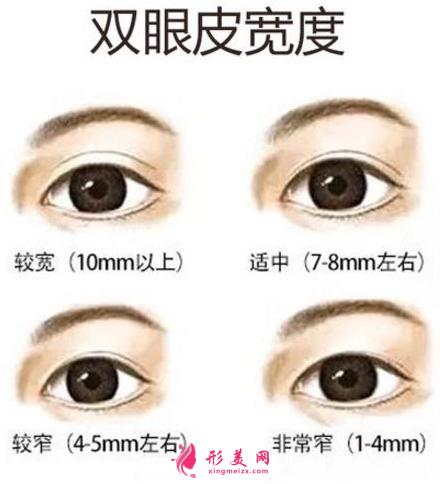 雙眼皮寬度