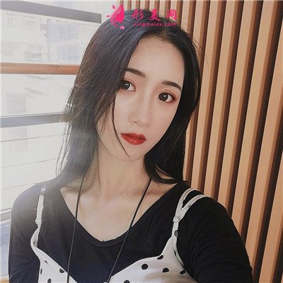 廈門全切雙眼皮手術(shù)術(shù)后效果分享 術(shù)后 廈門全切雙眼皮手術(shù)術(shù)后效果分享