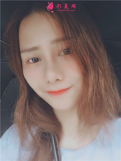北京水光針治療術后效果對比分析 術后 北京水光針治療術后效果對比分析