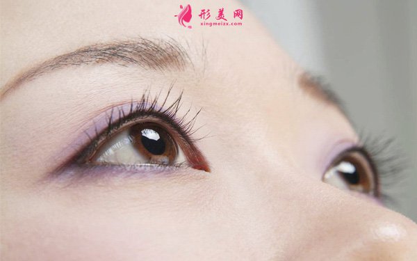埋線雙眼皮效果大概可以保持多久
