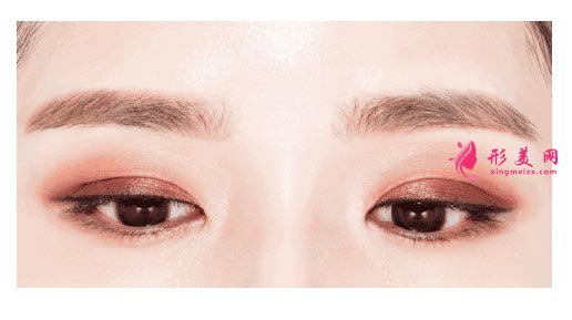 埋線雙眼皮多久可以化妝