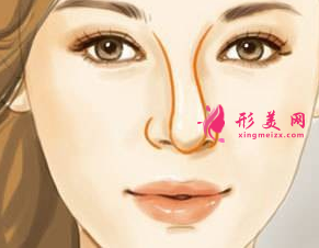 假體隆鼻歪斜了還能矯正嗎