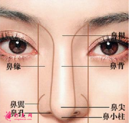 假體隆鼻歪斜了還能矯正嗎