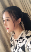 北京沃爾劉彥軍醫(yī)療美容綜合隆鼻案例分享