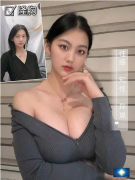 上海九院假體隆胸貴不貴？附真人假體隆胸案例
