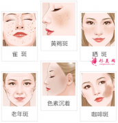 激光祛斑什么時(shí)候可以化妝