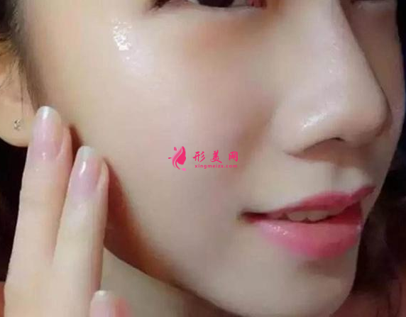 激光祛斑價格是怎么收費(fèi)的