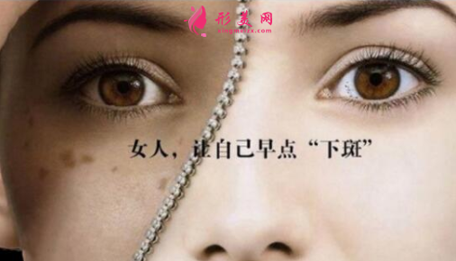激光祛斑價格是怎么收費(fèi)的