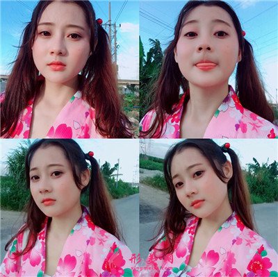 鄭州吸脂瘦臉手術術后效果對比 術后 鄭州吸脂瘦臉手術術后效果對比