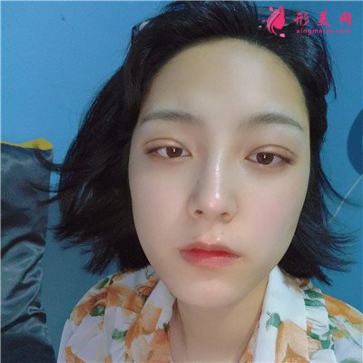 d298b5ab78da-audio.jpg