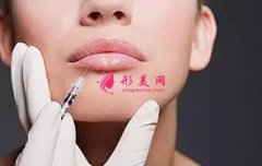 自體脂肪豐嘴唇效果怎么樣有哪些優(yōu)點?原理是什么?