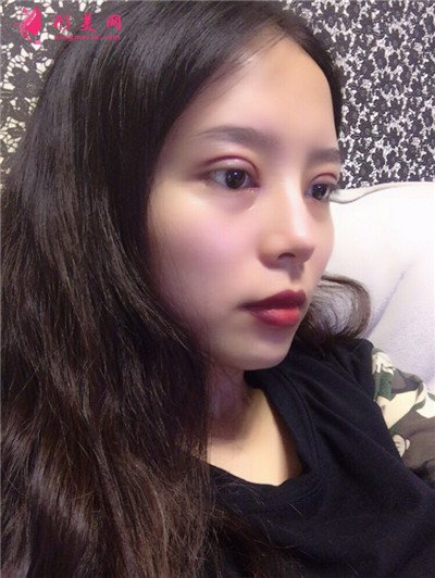 1f21d5f662bd-audio.jpg