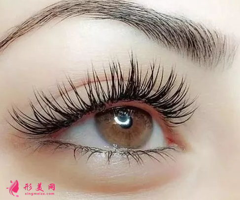 開眼角術(shù)后要什么護(hù)理