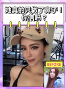廣州韓妃牟北平醫(yī)生的隆鼻案例，一個(gè)鼻子就改變了全臉