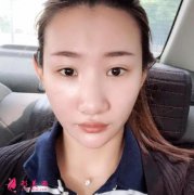 西京醫(yī)院燒傷整形科都做什么項(xiàng)目？附上隆鼻案例和收費(fèi)價(jià)格表
