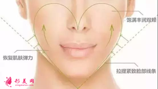 自體脂肪填充臉部是怎么收費(fèi)的