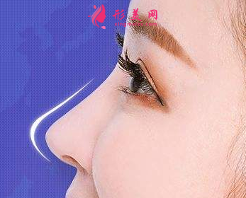 自體軟骨隆鼻后可以戴眼鏡嗎