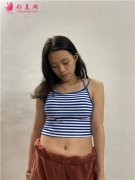 廣州曙光醫(yī)學(xué)美容醫(yī)院腰腹吸脂術(shù)后小姐姐恢復(fù)情況反饋