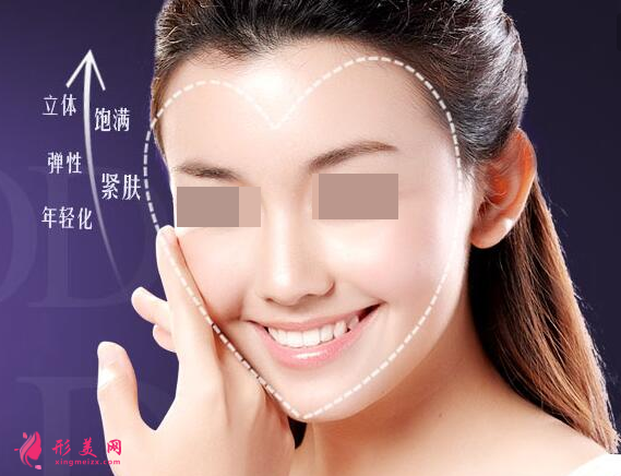 自體脂肪填充臉部腫脹明顯嗎