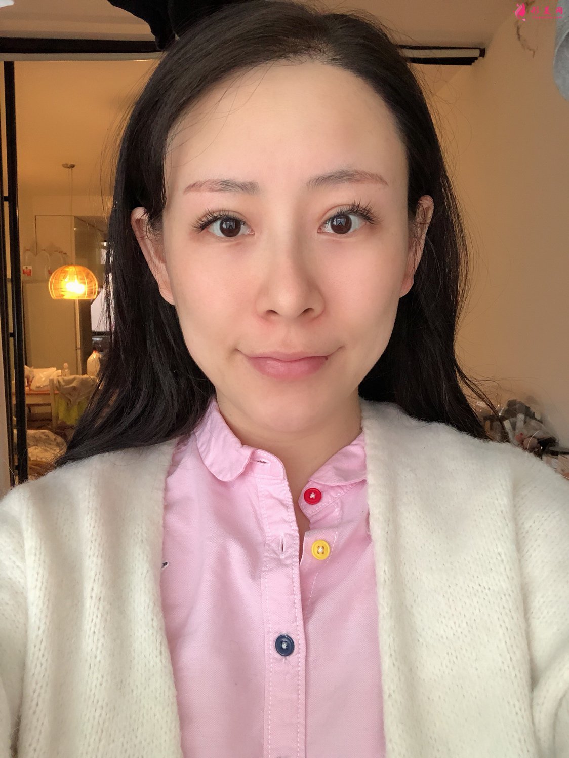 上海美萊醫(yī)療美容價(jià)格表，附自體脂肪豐額頭案例分享