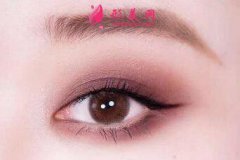 開眼角術(shù)后有疤痕怎么辦？