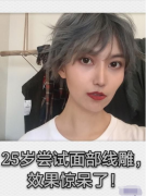 25歲找南京美貝爾潘梅焰醫(yī)生做埋線提升，開(kāi)始抗初老