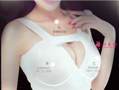 假體隆胸會有什么風(fēng)險嗎？