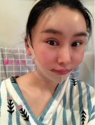 上海九院張?jiān)娎渍M怎么樣?真實(shí)案例和醫(yī)生個(gè)人資料分享~