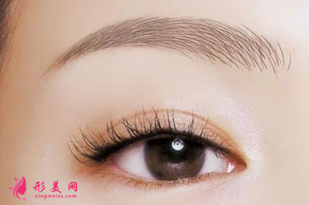 開眼角術(shù)后需要怎么護(hù)理