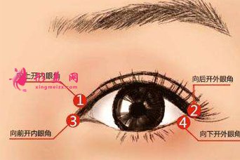 開眼角后要多久才能恢復