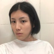 四川嬌點(diǎn)醫(yī)學(xué)美容醫(yī)院做面部填充怎么樣？