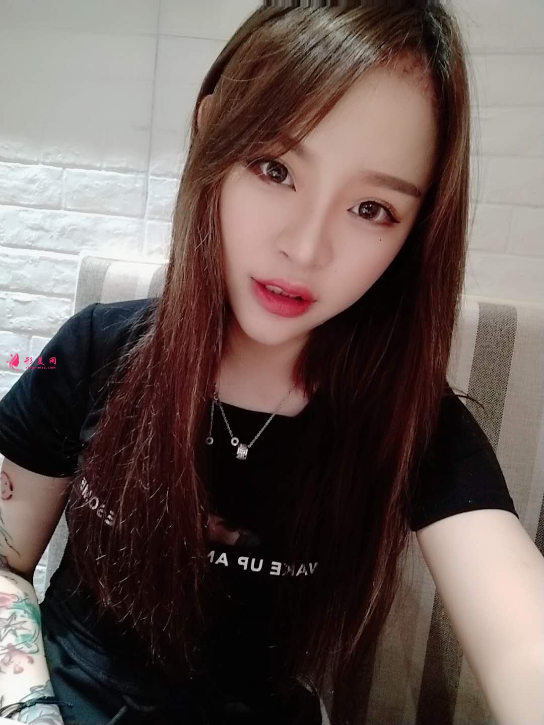 植發(fā)的效果能保持多久？