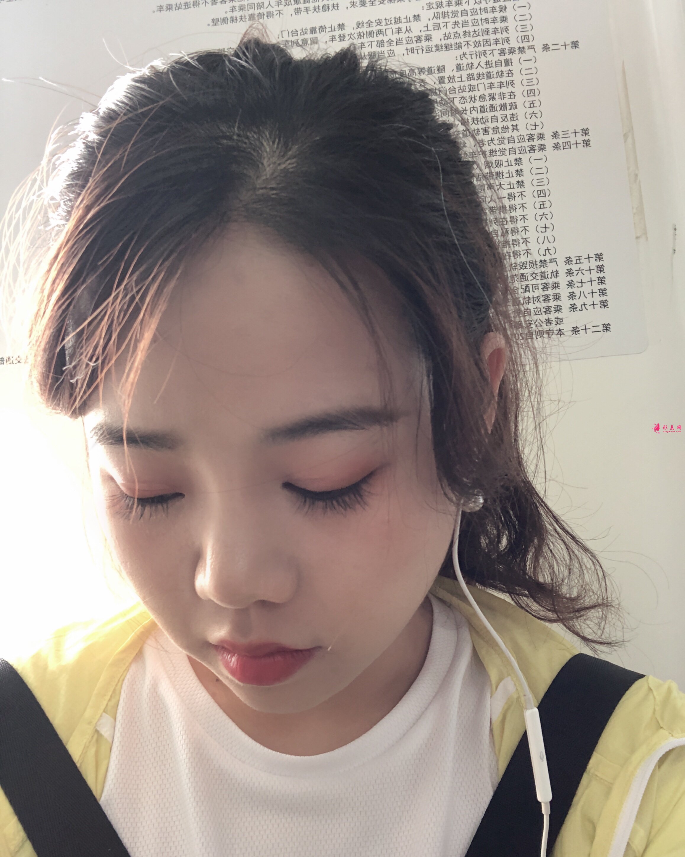 植發(fā)后還會脫發(fā)嗎？