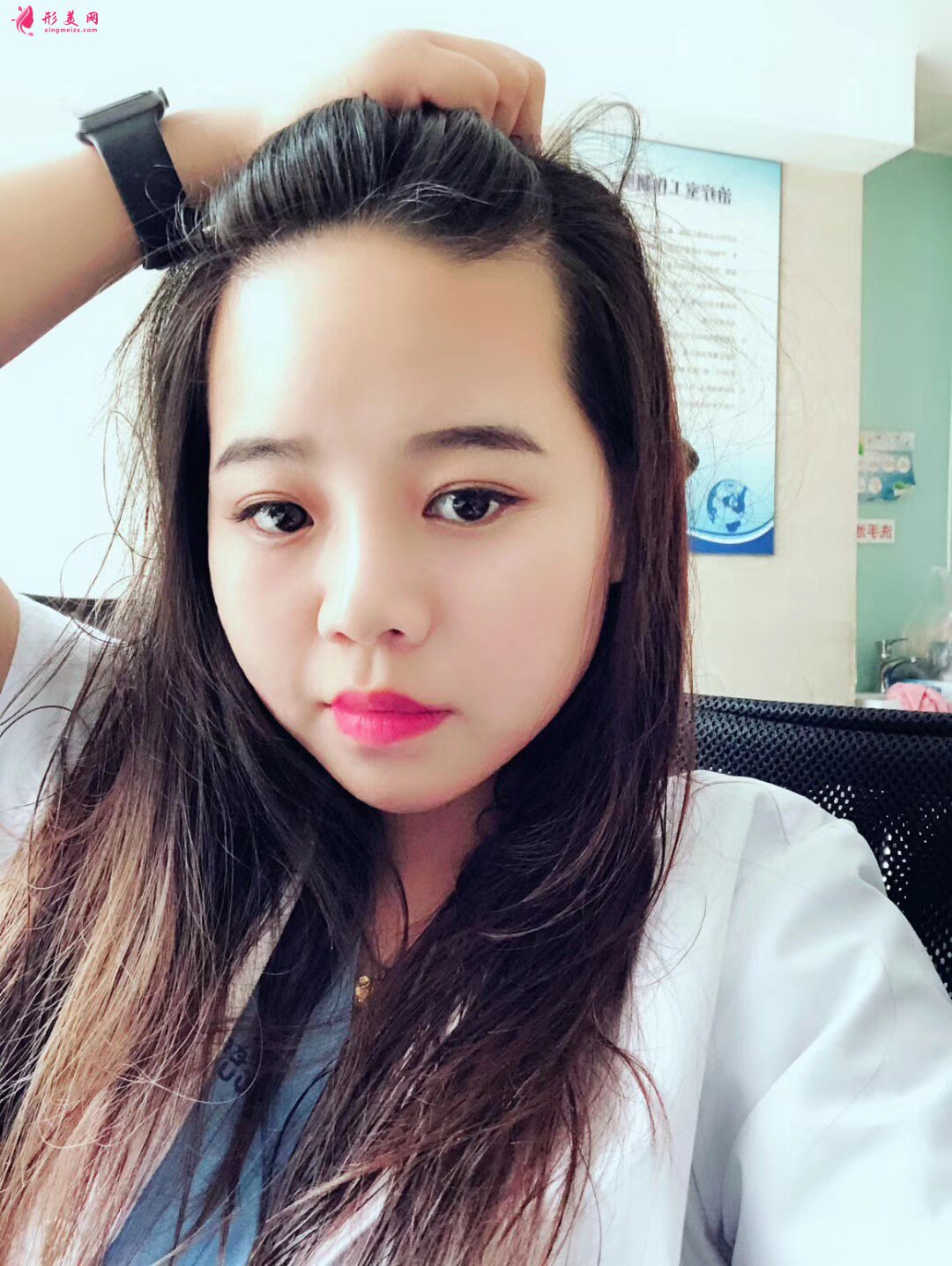 植發(fā)后還會脫發(fā)嗎？