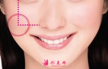 自體脂肪填充臉部費(fèi)用跟什么有關(guān)