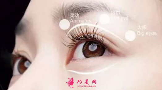 雙眼皮手術(shù)的風(fēng)險(xiǎn)大不大