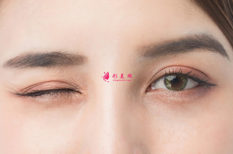 雙眼皮手術(shù)的風(fēng)險(xiǎn)大不大