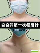 深圳鵬程李芳芳醫(yī)生打的瘦肩針，告別虎背熊腰