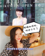 深圳富華郭建醫(yī)生雙眼皮案例，很自然的哦